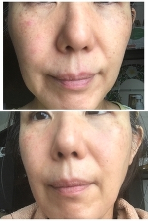 美容液と美顔器のセルフお手入れ実験中。