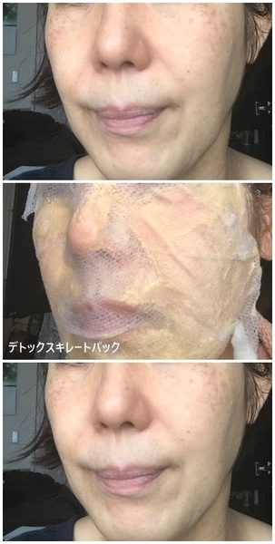 美白パックのビフォーアフター