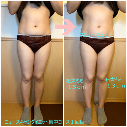 ニュースキャンダイエット集中コース１回目のモニターA様の結果