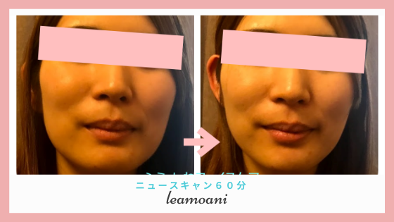 ヘッドフォンをつけて座って6０分のリフトアップ！！